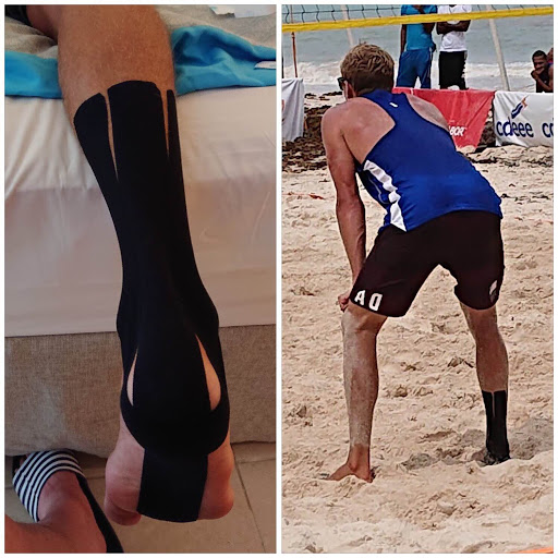 Best Hamstring Brace & Hamstring KT Taping by a Specialist